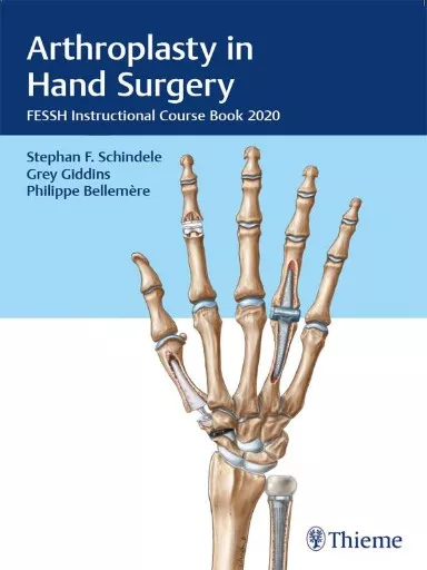 Anthroplasty in Hand Surgery book cover.