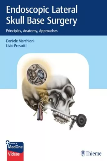 Endoscopic Lateral Skull Base Surgery book cover.