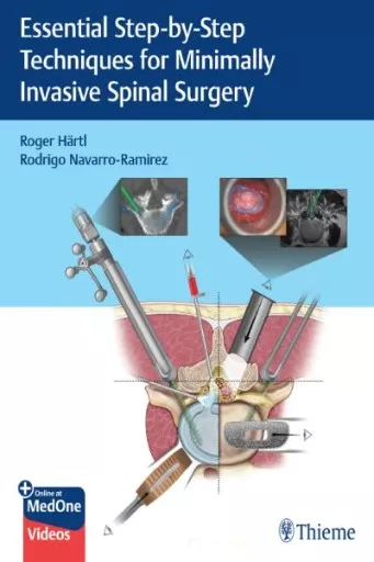 Essential Step-by-Step Techniques for Minimally Invasive Spinal Surgery book cover.